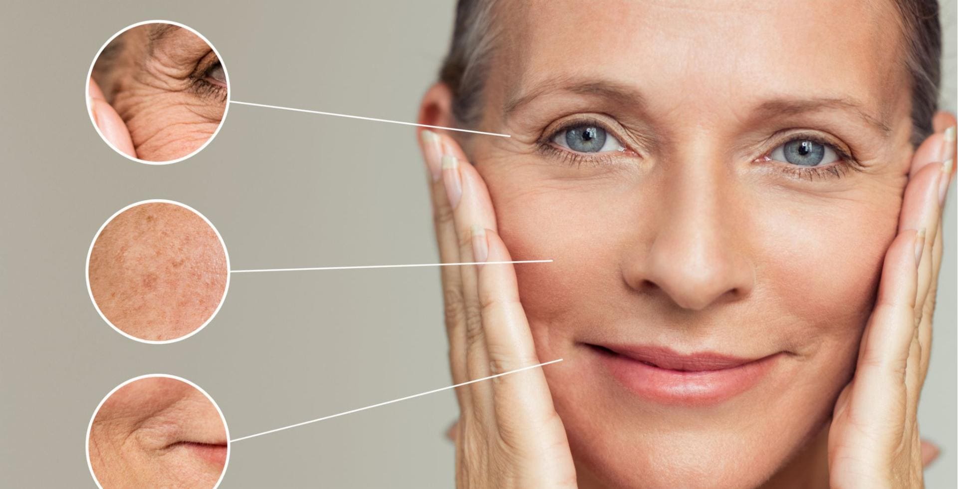 Hyaluronsäure Antifalten